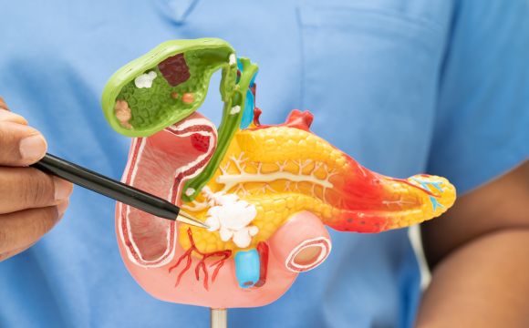 Colecistectomia: cirurgia da vesícula cirurgião explicando sobre a colecistectomia: cirurgia da vesícula